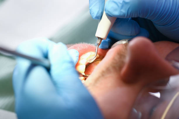 Professional Emergency Dental Service in NJ